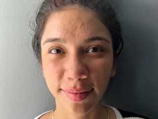 WebCAM of Amyglow_pk